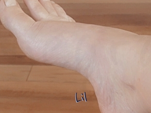 Lil